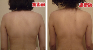 ビフォーアフター